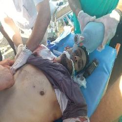 حماية: 20 أسبوع على مسيرات العودة ولا زالت قوات الاحتلال تمعن في ارتكاب جرائمها بحق المسعفين وأطقم الصحافة والمتظاهرين السلميين